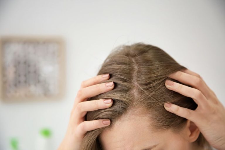 How to Soothe Bleach Burns on the Scalp & Why it Happens